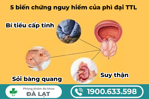 Hình ảnh minh họa